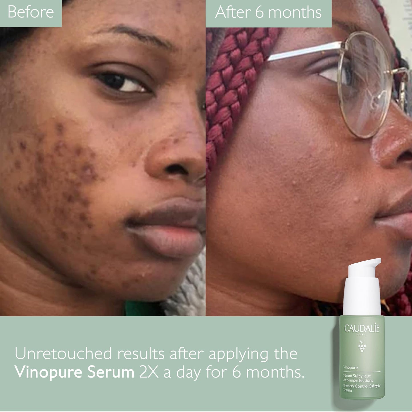 Caudalie Vinopure Natural Salicylic Acid Serum